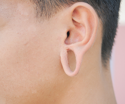 ear lobe without stitch stitchless