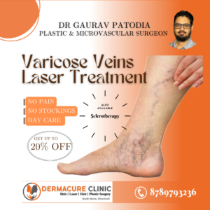 Varicose veins laser treatment